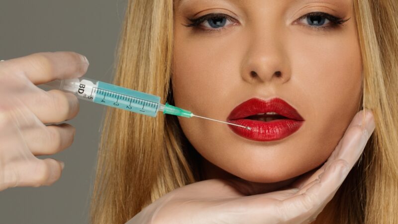 6 things I wish I’d known before getting lip injections