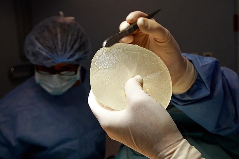 The first silicone breast implant was performed on a dog